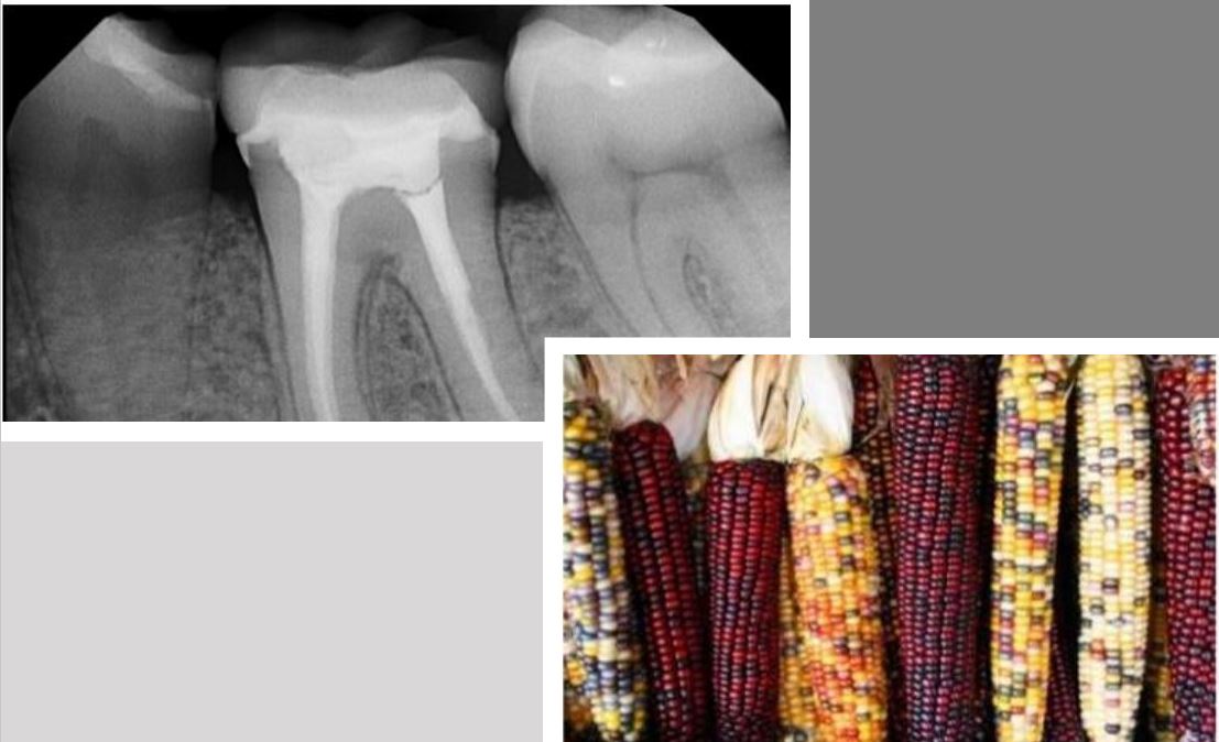 Images from https://fr.slideshare.net/Subhradeepsarkar/transposable-elements-in-maize-and-drosophila/16 and https://hospitallane.com/treatment/root-canal-treatment/